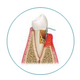 Icon zeigt Querschnitt von Zahn mit Zahnfleisch -  Knochens und des Zahnhalteapparates